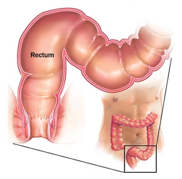 Rectum