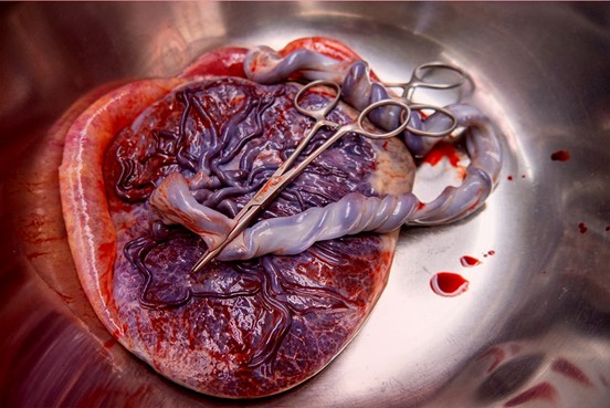 Placenta humain et cordon ombilical
