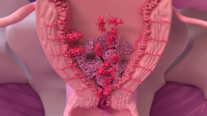 Utérus féminin durant la menstruation